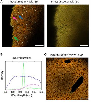 Tissue Intrinsic Fluorescence Spectra-Based Digital Pathology of Liver Fibrosis by Marker-Controlled Segmentation